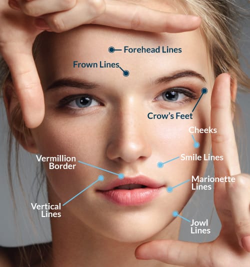 Minimize facial wrinkle lines at our expert practice near DePaul Unviersity, Chicago. Botox near Chicago Loop.